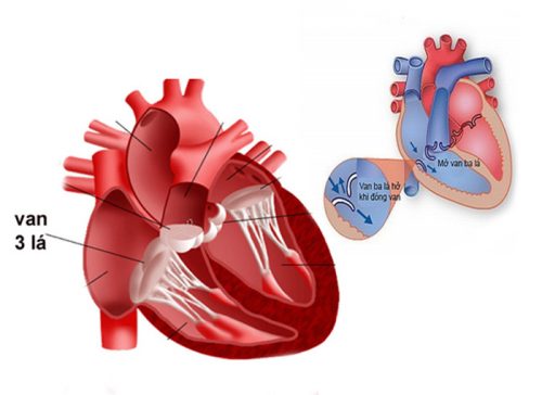 Dấu hiệu của bệnh hở van tim ba lá